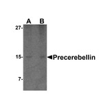 ProSci 3589 Precerebellin Antibody
