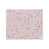 ProSci 3625 CRMP1 Antibody