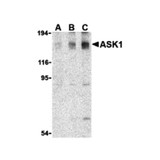 ProSci 3677 ASK1 Antibody