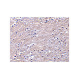 ProSci 3856 Clusterin Antibody