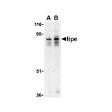 ProSci 3965 Lipe Antibody