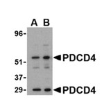 ProSci 3975 PDCD4 Antibody