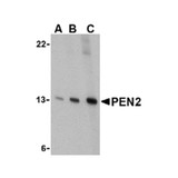 ProSci 3979 PEN2 Antibody