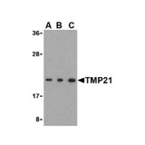 ProSci 3997 TMP21 Antibody