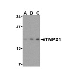 ProSci 3999 TMP21 Antibody