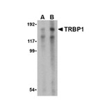 ProSci 4011 TRBP1 Antibody