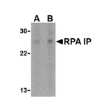ProSci 4013 RPA Interacting Protein Antibody