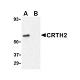 ProSci 4027 CRTH2 Antibody
