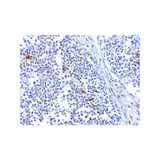 ProSci 4039 MDA5 Antibody