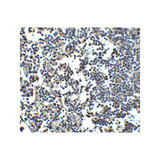 ProSci 4037 MDA5 Antibody