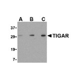 ProSci 4049 TIGAR Antibody