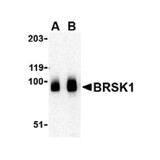 ProSci 4081 BRSK1 Antibody