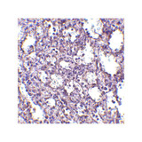 ProSci 4125 STIM2 Antibody