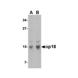 ProSci 4237 op18 Antibody