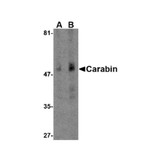 ProSci 4269 Carabin Antibody