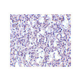 ProSci 4269 Carabin Antibody