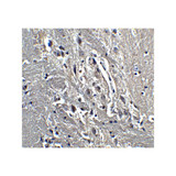 ProSci 4289 KIF5 Antibody