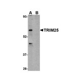 ProSci 4315 TRIM25 Antibody
