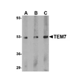 ProSci 4339 TEM7 Antibody