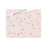 ProSci 4331 BRCC36 Antibody