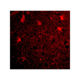 ProSci 4331 BRCC36 Antibody