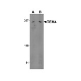 ProSci 4367 TEM4 Antibody