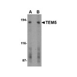 ProSci 4369 TEM5 Antibody