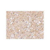 ProSci 4407 IPR1 Antibody