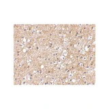 ProSci 4407 IPR1 Antibody