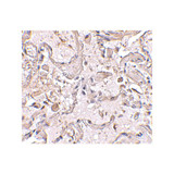ProSci 4413 GSTP1 Antibody