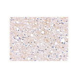 ProSci 4417 Plxdc2 Antibody