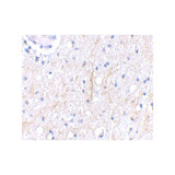 ProSci 4419 Plxdc2 Antibody