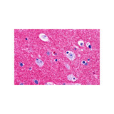 ProSci 4447 RIM2 Antibody