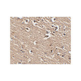 ProSci 4453 Slitrk1 Antibody