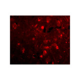 ProSci 4457 Slitrk2 Antibody