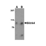 ProSci 4473 Slitrk4 Antibody