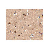 ProSci 4473 Slitrk4 Antibody