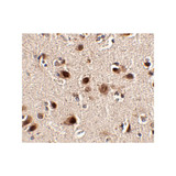 ProSci 4475 Slitrk5 Antibody