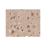 ProSci 4477 Slitrk5 Antibody