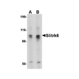 ProSci 4479 Slitrk6 Antibody