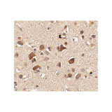 ProSci 4479 Slitrk6 Antibody