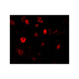ProSci 4483 Slitrk4 Antibody