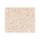 ProSci 4533 LGI2 Antibody