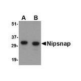 ProSci 4537 NIPSNAP Antibody