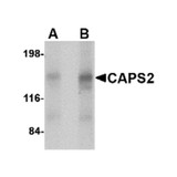 ProSci 4565 CAPS2 Antibody