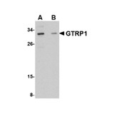 ProSci 4591 GRTP1 Antibody