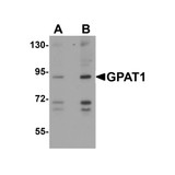 ProSci 4613 GPAT1 Antibody