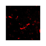 ProSci 4625 SAPAP2 Antibody