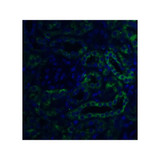ProSci 4651 Slc22A17 Antibody