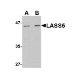 ProSci 4697 LASS5 Antibody